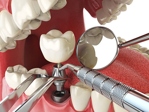 Best Pediatric Emergency Dentist in Mead, WA